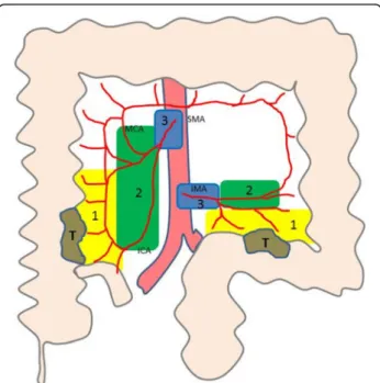 Fig. 1 Assessment of right and left sided tumours (T) and their corresponding anatomical distribution of lymph nodes