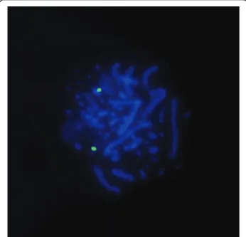 Figure 4 FISH using DOP-PCR products. FISH using DOP-PCR products of the nanodissected duplication (1p)(p22-p23).