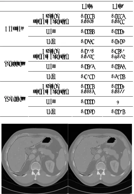 Figure 4. Comparison between standard level set and pro- posed method. 