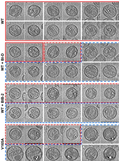 FIG 5 Tomo-bubblegrams of HIV-1 particles. (A to X) Each pair of panels shows a central section from an initial tomogram (left) and the corresponding section fromthe tomo-bubblegram (right)