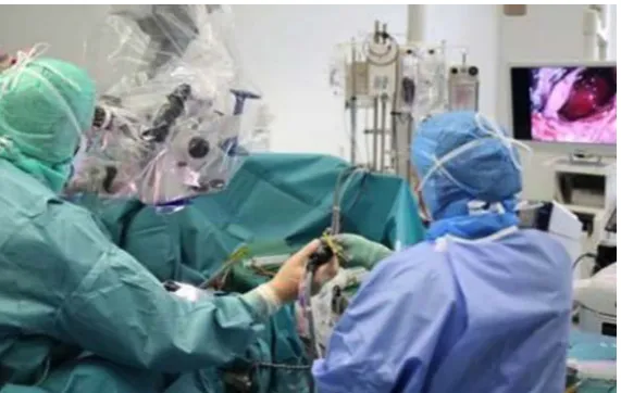 Figure 2. FOR operating theater for neurosurgery. Optical tracking is used for locating the surgical instruments, while the surgeon visualizes the surgical field relying on an optical microscope