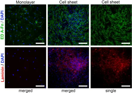 Figure 4. Heterogeneity of ECM deposition in CS compared to 