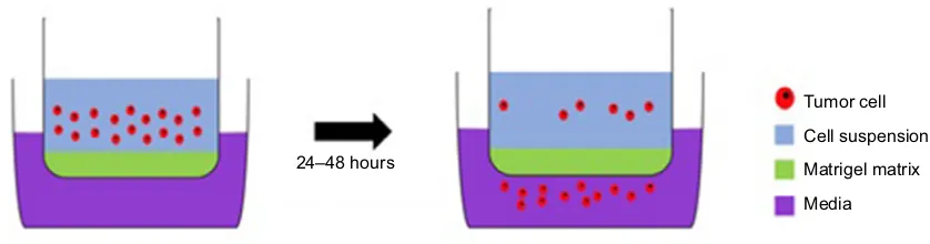 Figure 2 A Matrigel assay: an invasion assay which allows the experimenters to assess the invasive potential of cells through the Matrigel-filled pores in a membrane separating the two compartments; this resembles invasion through the eCM.Abbreviation: eCM, extracellular matrix.