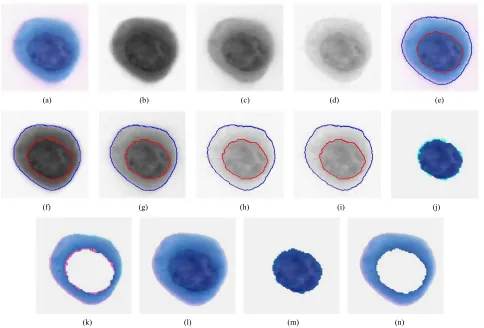 Figure 3. Color cervical cell image segmentation results: (a) Original color cell image; (b)-(d) Red, green and blue channels 
