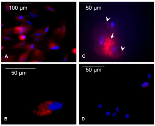 Fig. 2. The localization of TRPC1 in bone marrow mesenchymal stem cells (MSC)  assessed via anti-TRPC1 immuno-fluorescence