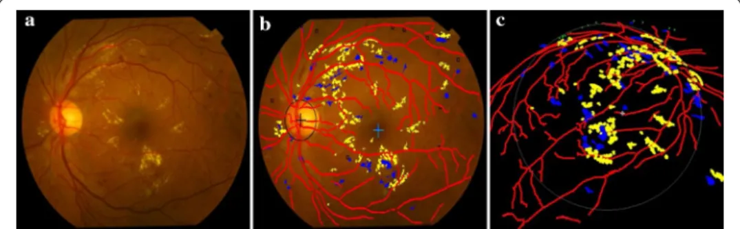 Fig. 8  Detection results of the main fundus targets and 3D reconstruction based on human eyes structure