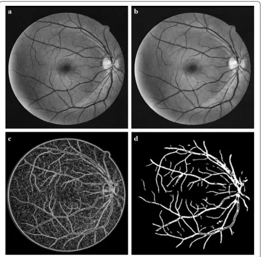 Fig. 3  Segmentation results of blood vessels based on PC. a Contrast Enhancement using CLAHE