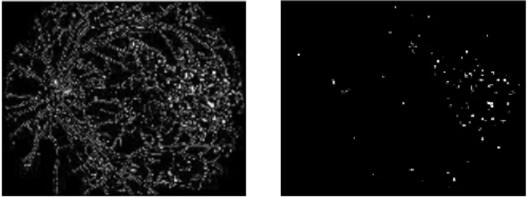Figure 19: Image with boundary (left) &amp; Image obtained after subtraction of boundary from Canny Image  (right) 