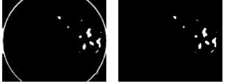 Figure 27 exclusively  shows the thresholding  operation that has been performed by using the value 0.6 &amp; then  morphological closing operation is applied to fill holes in the exudates if present