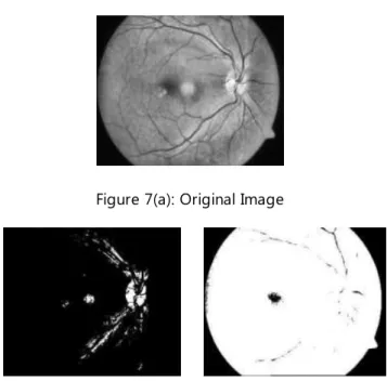 Figure 8: Original Image (left) &amp; Canny Image (right) 