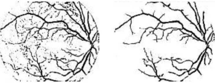 Figure 14: Image after subtraction (left) &amp; Image after thresholding (right) 