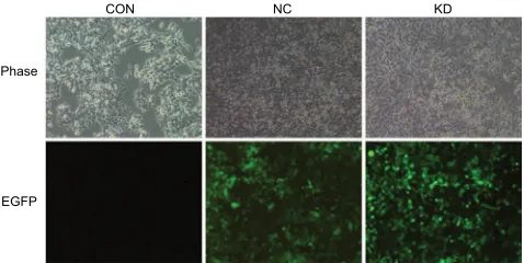 Figure 1 Colorectal cancer cell line hCT116COn and the stable transfected cell lines hCT116nC and hCT116KD screened by puromycin.Notes: Representative phase and green fluorescence images of live control, negative control and claudin-7 knockdown cells