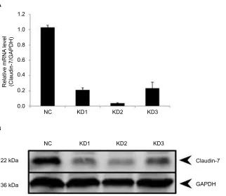 Figure 3 electron microscope results of hCT116nC and hCT116KD cells.Notes: (A, B) The arrowhead indicates the apical tight junction between cells in HCT116NC and HCT116KD (magnification: 8000×)