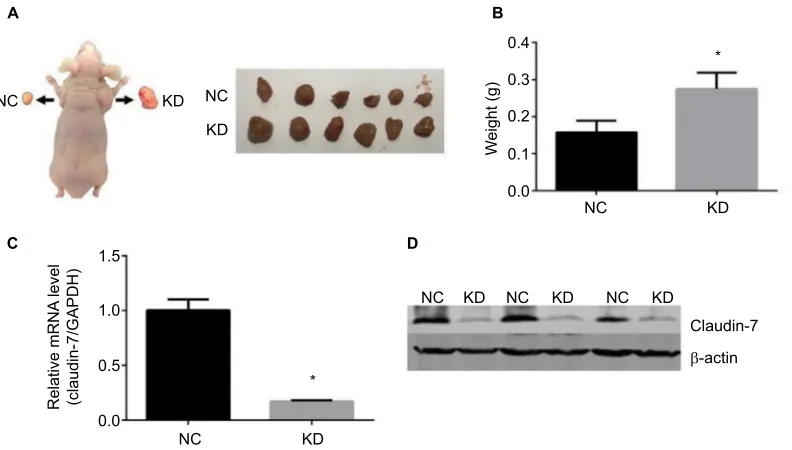 Figure 4 increased cell proliferation and migration and decreased cell apoptosis in claudin-7 KD cells.Notes: (A) The detection of cell viability of CRC cell line hCT116COn and stable transfected cell lines hCT116nC and hCT116KD