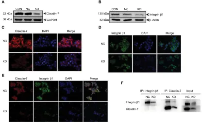 Figure 6 Decreased protein levels and disrupted localization of integrinNotes:the expression of integrinclaudin-7 protein in stable transfected cell lines HCT116NC and HCT116KD were detected by cellular immunofluorescence assay