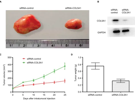 Figure 5 effect of COl5a1 knockdown on tumor growth in vivo.Notes: (A) Knockdown of COl5a1 by siRna inhibited the growth of Caki-1-derived xenografts in nude mice