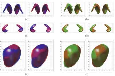 Figure 13. First and second principal modes of variation in the   (a)–(b) caudate (c)–(d), hippocampi, and ¯