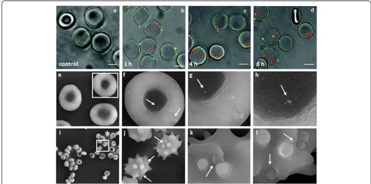 Figure 3 Passive NP uptake by red blood cells. (a – d) Internalization of DPA-QDs (8 nm) [77]