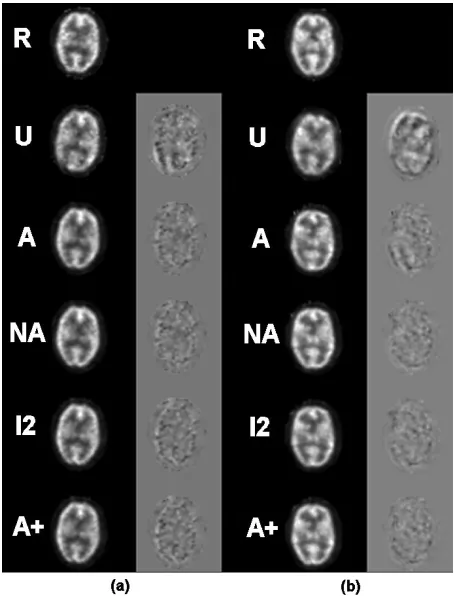 Fig. 6.Upper, middle, and lower (left to right) brain slices for (a) dataset 5and (b) dataset 7