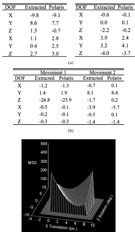 Fig. 9.Surface plot of the similarity measure for one of the physical phantomdatasets, showing a valley traversing the x-translation z-rotation parameterspace