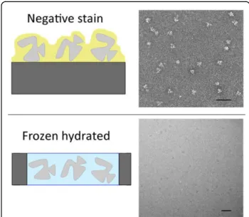 Figure 1 Preparation of purified molecular complexes for electron microscopy. In negative stain the specimen is adsorbed on a carbon film, embedded in a layer of heavy metal salts and dried
