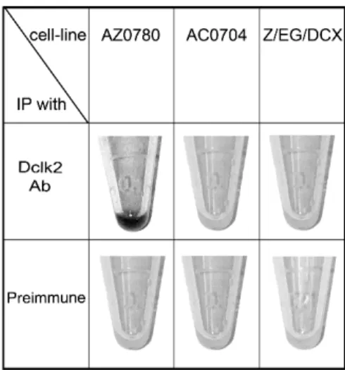 Fig. 4. The LacZ reaction of immunoprecipitated proteins. Cell lysates from AZ0780,  AC0704 and Z/EG/DCX were immunoprecipitated with DCLK2 antibodies (top row) or  preimmune serum (bottom row)