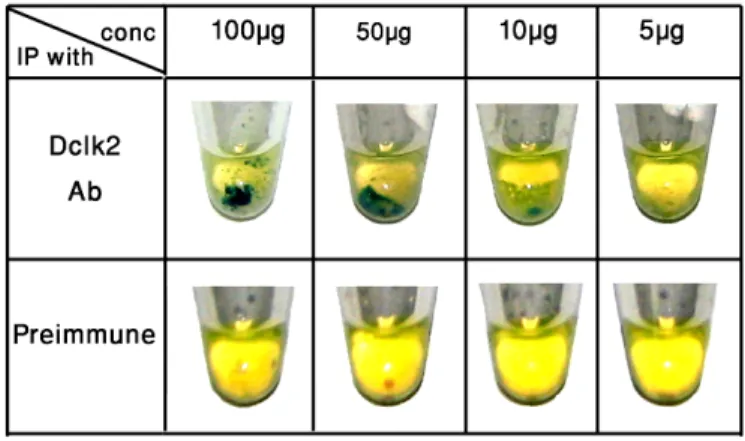 Fig. 6. The LacZ reaction of the immunoprecipitated proteins. The cell lysate from  AZ0780 was diluted to different concentrations and immunoprecipitated with DCLK2  antibodies (top row) or preimmune serum (bottom row)
