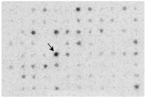 Fig. 1. Subtraction suppression hybridization. The spots expressed in antimycin A-treated  cells are presented as described in the text