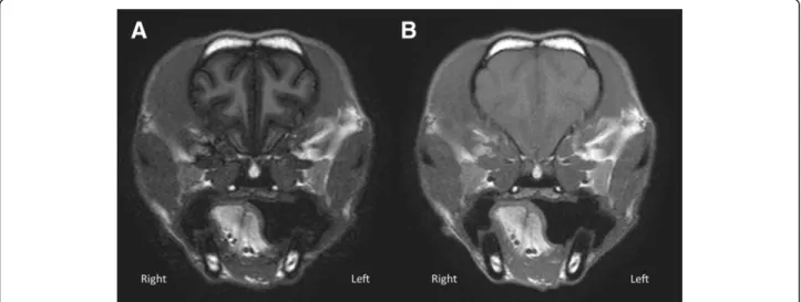 Fig. 2 a Transverse T1wFLAIR (TE/TR/TI: 16 ms/2000 ms/600 ms; NEX: 2. ms; slice thickness 3 mm; Window Level: 797; Window Width: 1887); b) Transverse T1wTSE (TE/TR: 11 ms/470 ms; NEX: 3