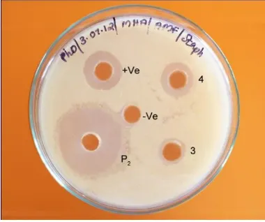 Fig. 3: Antibacterial activity of Extract against Clinical pathogens. 