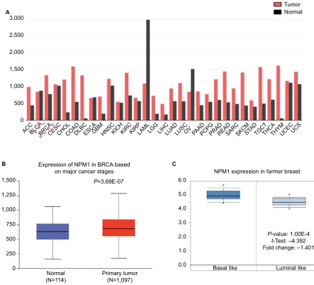 Figure 1 Expression profiles of NPM1 in breast cancer tissue samples from an array of databases.Notes: (A) The mRna expression of nPM1 in different tumor types