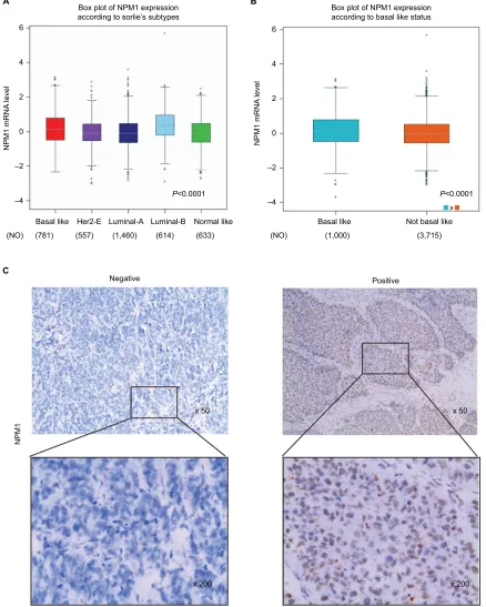 Figure 2 NPM1 was significantly highly expressed in triple-negative breast cancer and associated with active proliferation.Notes: (A) The expression of nPM1 in eR-positive and eR-negative tumors