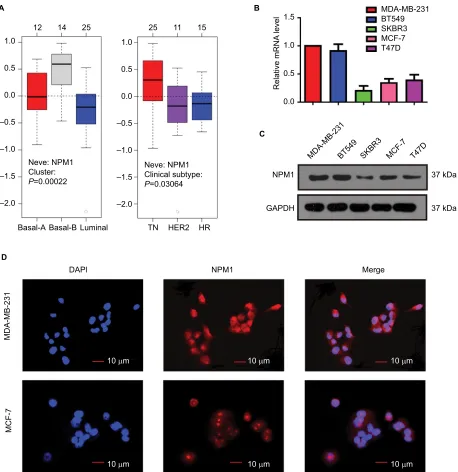 Figure 3 analysis. (MB-231 and MCF-7 cells stained with anti-nPM1 (red signal).Abbreviations:expression of nPM1 was distinct in different breast cancer cell lines