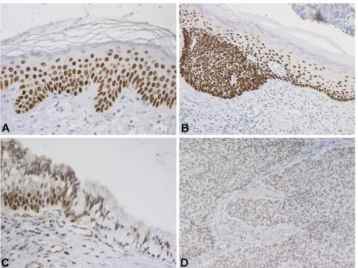 Fig. 2. Immunohistochemical staining of p63 in various tissue samples. A – p63 in normal  stratified epithelium of the skin