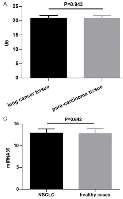 Figure 1. A. Comparison of U6 expression between lung cancer tissues and para-carcinoma tissues