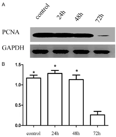 Figure 5. ATO decreased the expression of PCNA re-vealed by western blot. RPE cells were treated at 6 μmol/L ATO for 24, 48, and 72 h