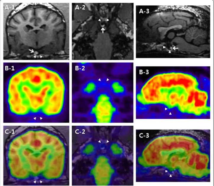 Fig. 1 FDG-PET and 7 T MRI characteristics of a canine pituitary microtumor. Transverse (1), dorsal (2), and sagittal (3) images at the level of the pituitary gland are pictured from left to right