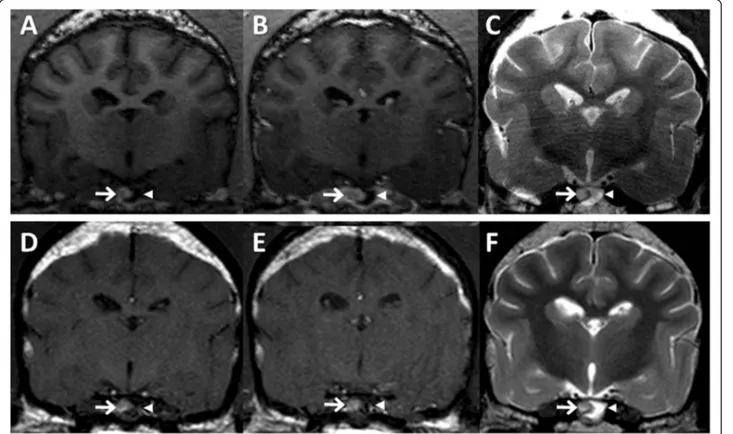Fig. 2 High-resolution MRI characteristics of a canine pituitary microtumor. Following initial 7 T MRI scan (a –c), a pituitary lesion was re-evaluated by 3 T MRI 6 months later (d –f)