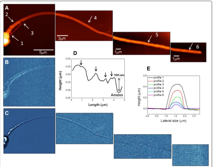 Figure 3 Reconstruction of a human spermatozoon as imaged by SNOM. (A) SNOM topography, (B) SNOM optical reflection and (C) transmission images