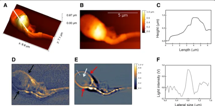 Figure 6 SNOM image of the principal part of the human sperm tail. (A) SNOM 3D topography, red arrows indicate the cross circumferential structures one after another along the tail; (B) SNOM optical reflection and (C) transmission, where the white arrow in