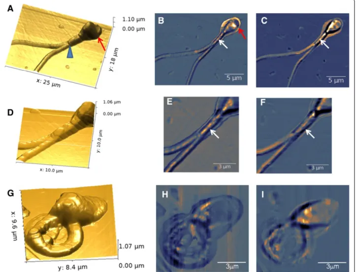Figure 7 Human spermatozoa having morphological anomalies as imaged by SNOM. (A) 3D SNOM topography of two tail spermatozoa: blue arrowhead indicates the end of midpiece, while red arrow indicates the end of post-acrosome area