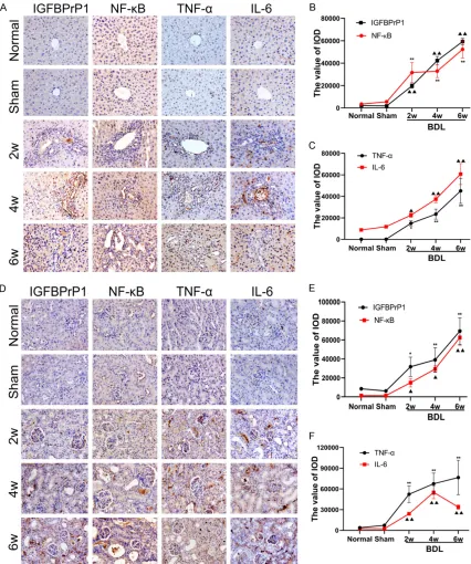 Figure 2. The expression of insulin-like growth factor binding protein-related protein 1 (IGFBPrP1), NF-κB, TNF-α, and IL-6 in liver and kidney of mice