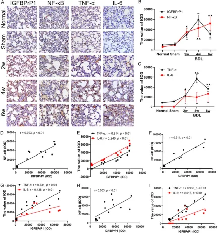 Figure 3. The expression of insulin-like growth factor binding protein-related protein 1 (IGFBPrP1), NF-κB, TNF-α, and IL-6 in lung of mice; the correlation between IGFBPrP1 and the expression of NF-κB, TNF-α and IL-6 in liver, kidney and lung tissues