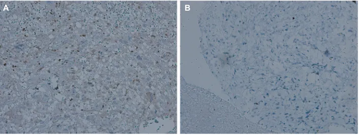 Table 1 immunohistochemical staining of giT1 in all patient-derived Os tissues