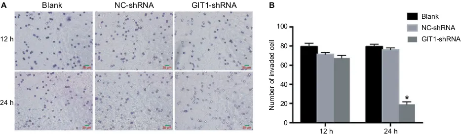 Figure 3 Knockdown of giT1 inhibited invasion of osteosarcoma cells.assay. (nC-shRna and giT1-shRna group was conducted (scale bar: 20 µm; *Notes: OsT cells were infected with giT1-shRna, nC-shRna or blank control for 24 and 48 hours respectively