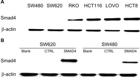 Figure 3 Generated stable Smad4 reexpression in human colon cancer cells.Notes: (A) Expression of Smad4 in six kinds of colon cancer cells including SW480, SW620, RKO, HCT116, LOVO, and HCT8 by WB