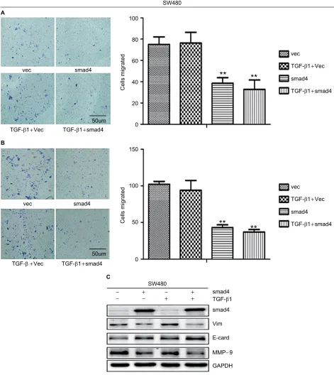 Figure 4 Migration and invasion assay in SW480 cells following stable Smad4 reexpression.Abbreviations: Notes: (A) Transwell cell migration and (B) invasion assay in Smad4-negative and Smad4-positive SW480 cells in the case of adding and without adding TGF