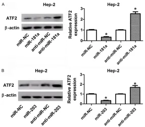 Figure 5. miR-181a and miR-203 suppressed ATF2 expression by direct complementary binding sites