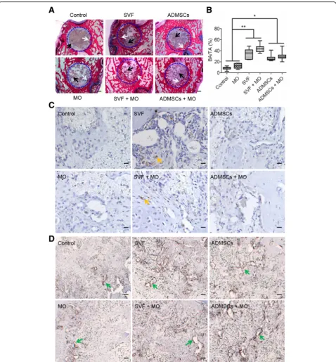 Fig. 4 New bone quantification and representative images of histology and immunohistochemistry staining after 4 weeks implantation in theYellow arrows indicate positive staining.femoral condyle bone defect