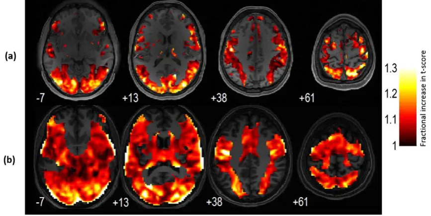 Fig. 2. Group-level activation maps (p b 0.05, FWE) for a speech-processing task using the standard analysis (a) and VasA fMRI (b)